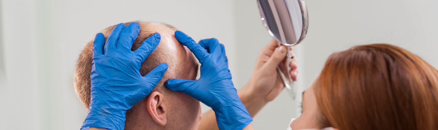 All Answers Regarding Hair Transplantation in Turkey (Updated 2023)