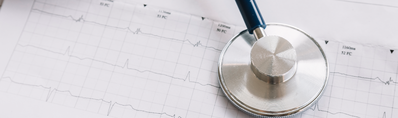 What Are Arrhythmias: Types, Causes, And Symptoms