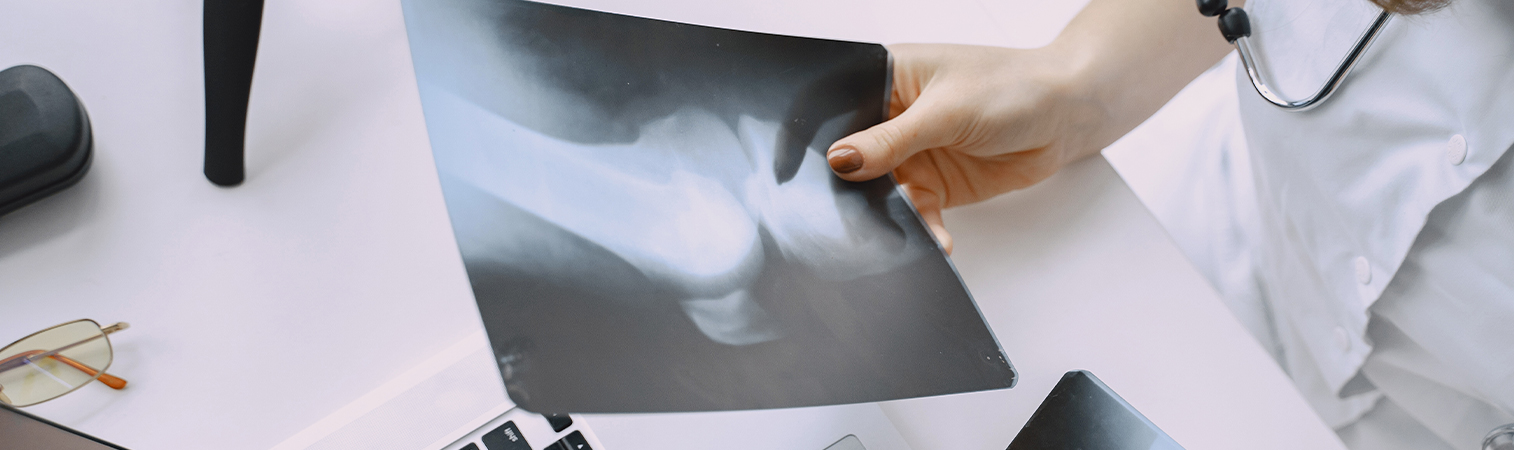 What Exactly Is Bone Cancer And How Is It Treated?