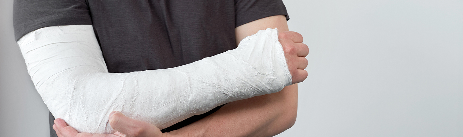 What Is A Broken Arm? How Is The Treatment?