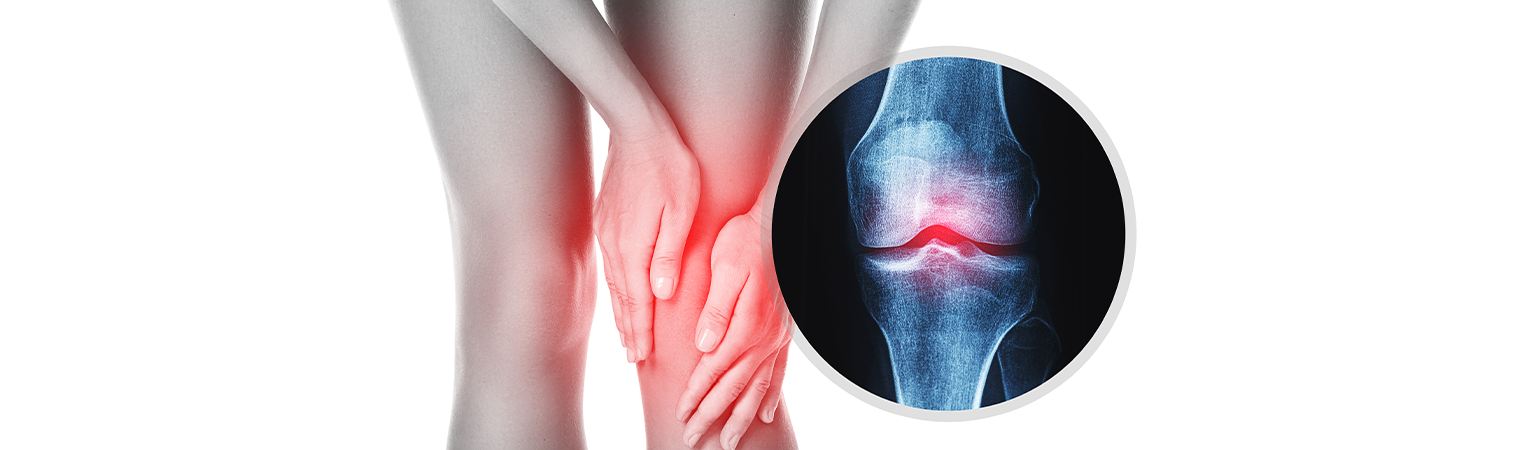 What Is Knee Arthroscopy And How Does It Work?