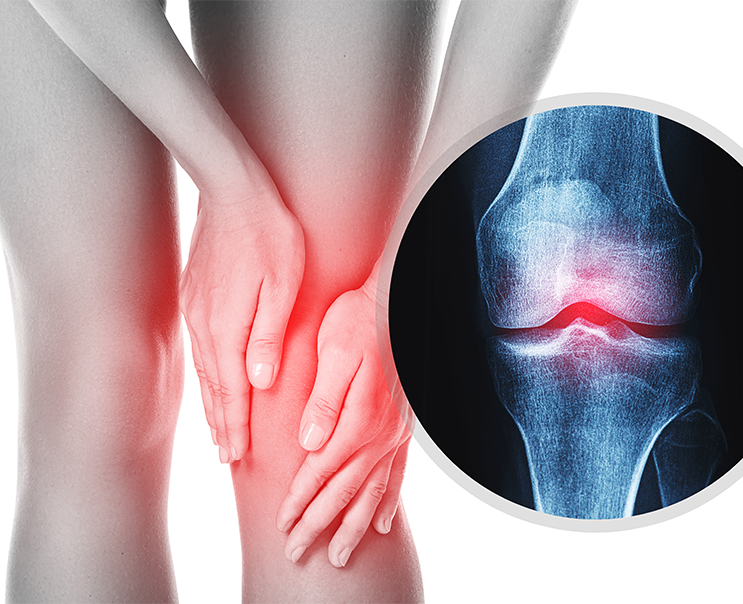 What Is Knee Arthroscopy And How Does It Work?
