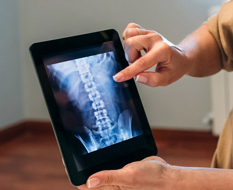 Spine Surgery: What Is A Cervical Herniated Disc, And What Are The Treatment Methods?