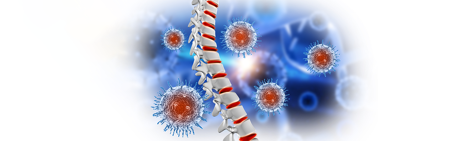 Spinal Cord Tumors: What Are Its Causes And Symptoms